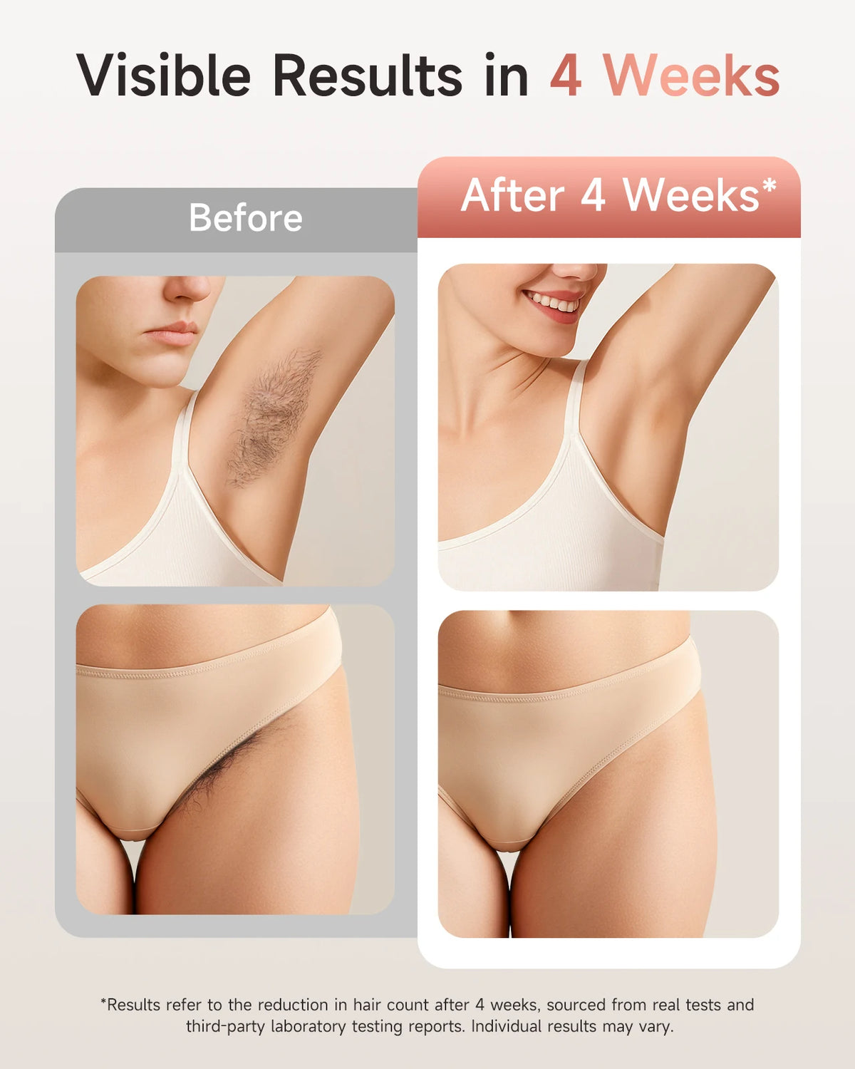 Unlimited Flashes IPL Hair Removal 9 Energy Levels Epiladora Laser with Acne Treatment for Women’s Body and Bikini Line Home Use
